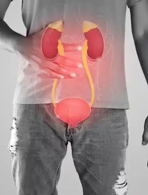 consulta-urologica-para-enfermedad-de-peyronie-en-cdmx.webp