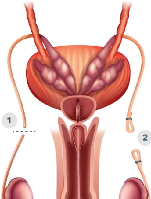 los-mejores-urologos-en-miguel-hidalgo-cdmx.webp