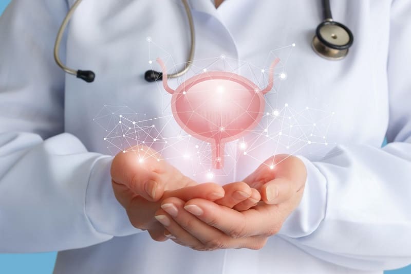 Cistectomía Radical: El Tratamiento Definitivo para Enfermedades Urológicas