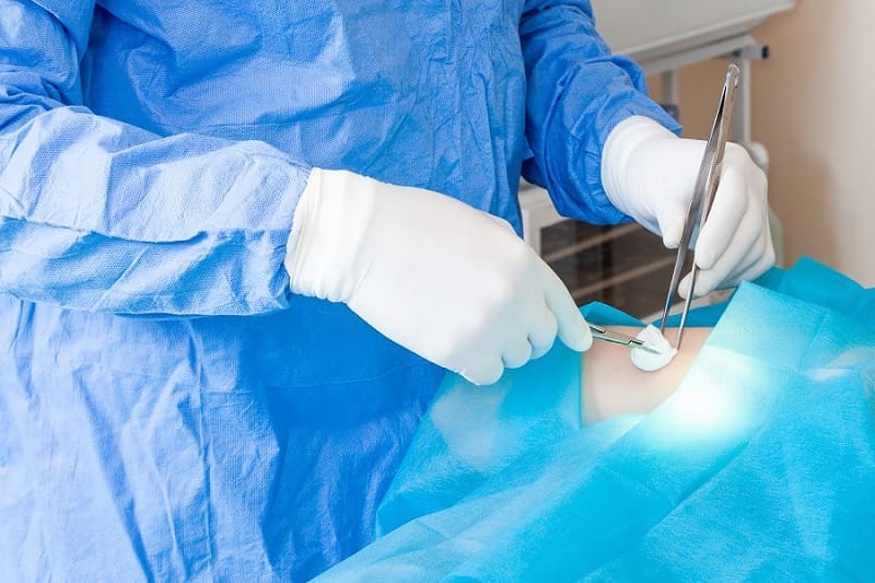 Cisto sacropexia laparoscopica ofrecido por Dr. Ulises Cristóbal Sanchez Aquino