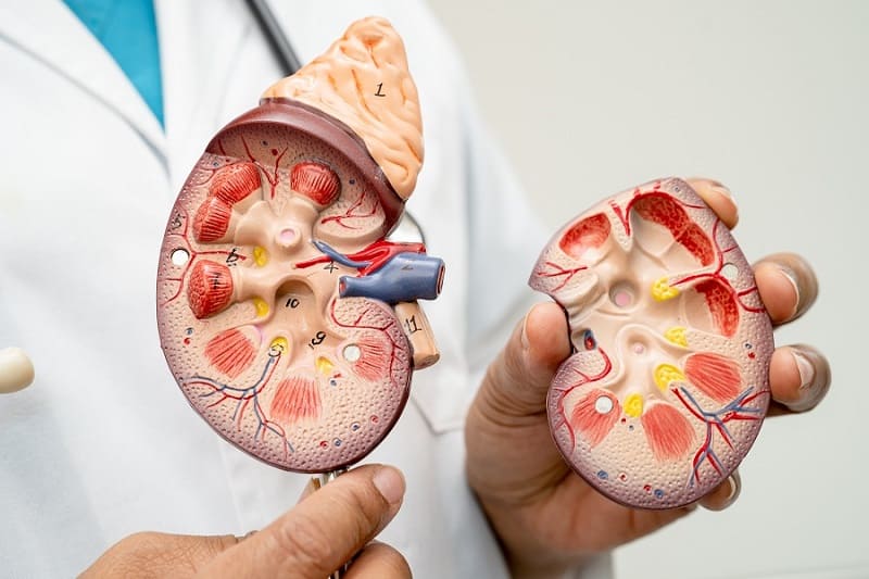 Nefrolitotomía Percutánea Ofrecida por Dr. Ulises Cristóbal Sánchez Aquino: Una Solución Efectiva para los Cálculos Renales