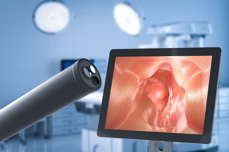 Ureteroscopia láser ofrecido por Dr. Ulises Cristóbal Sánchez Aquino - confiable en Urología