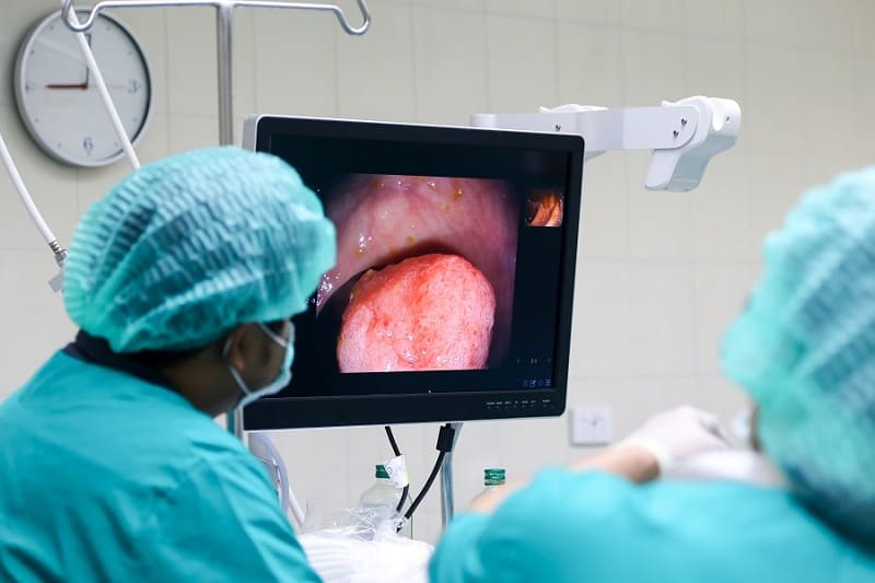 Uretrotomía interna con láser